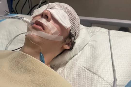 警方称,举报多伦多狗被刺伤的人就是伤害狗的人