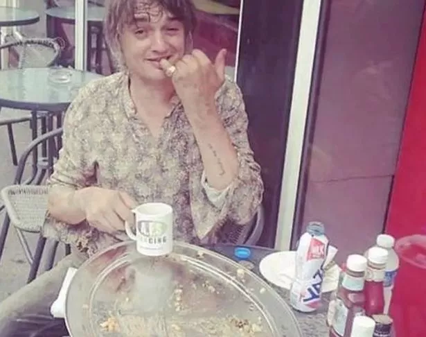 皮特·多尔蒂用“过量”的奶酪和香肠代替了海洛因