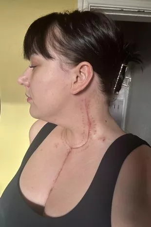 “医生告诉我通过冥想来消除焦虑,然后我发现了数百个癌症肿块。”