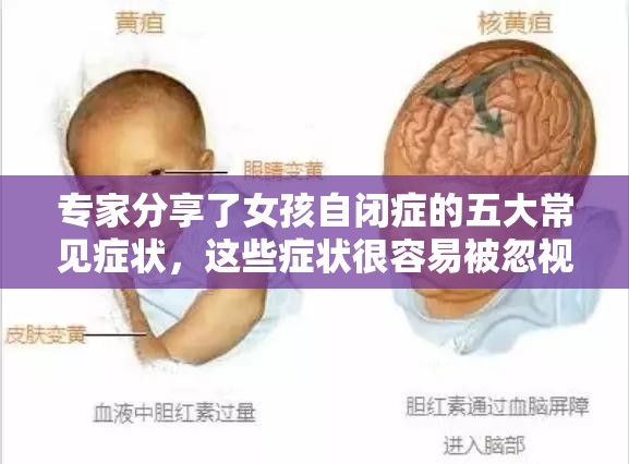 专家分享了女孩自闭症的五大常见症状，这些症状很容易被忽视